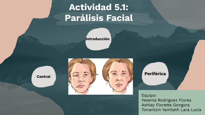 Parálisis Facial by Tonantzin Lara on Prezi