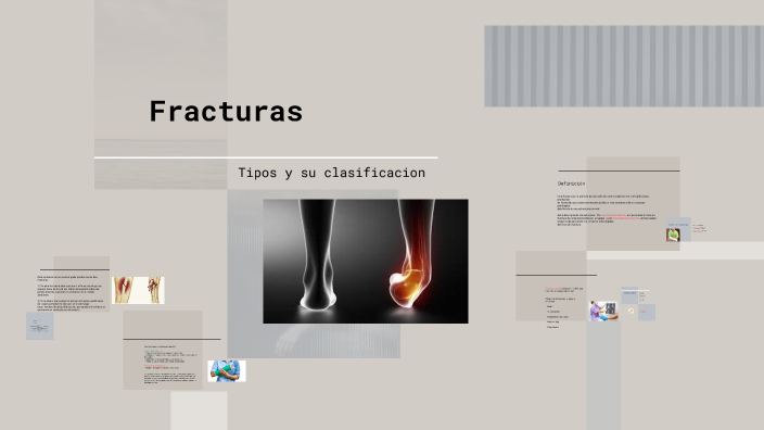 Fracturas Óseas by Rocio Florencio on Prezi