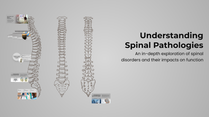 Understanding Spinal Pathologies by Abdul Moeez Khan on Prezi