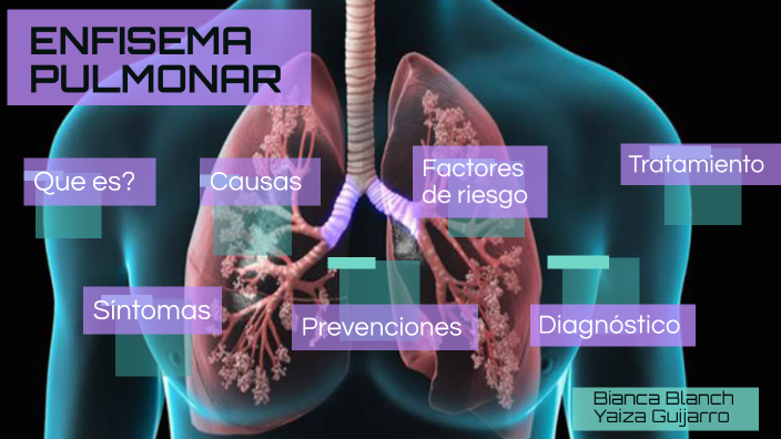 Enfisema Pulmonar By Bianca Blanch Benitez On Prezi