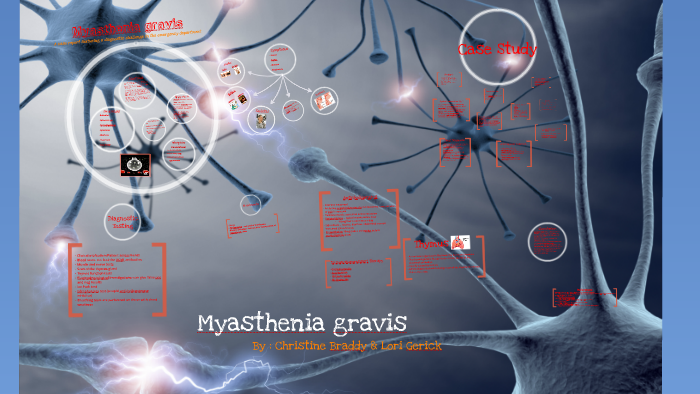 Remdesivir In Myasthaenia Gravis : New Consensus Guidance ...