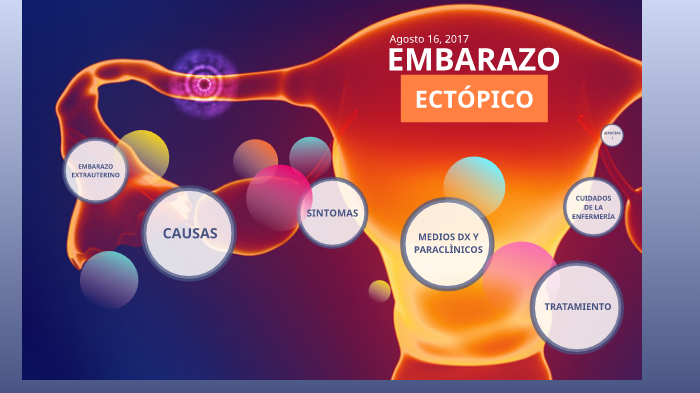 Embarazo EctÓpico By Paula Nuñez On Prezi 2357