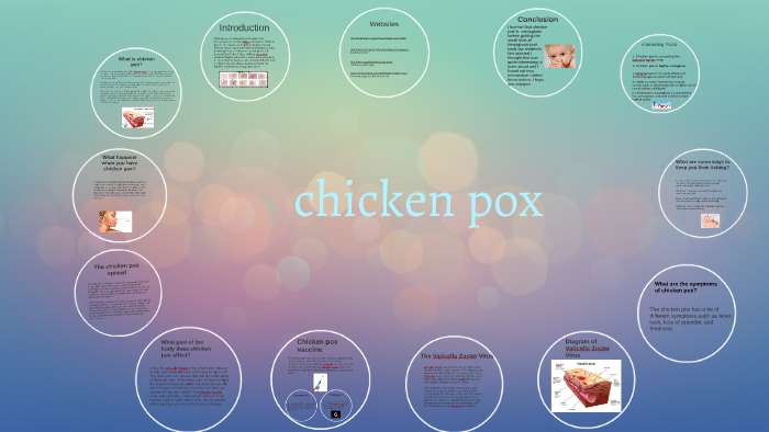 chicken pox by Ashley B on Prezi