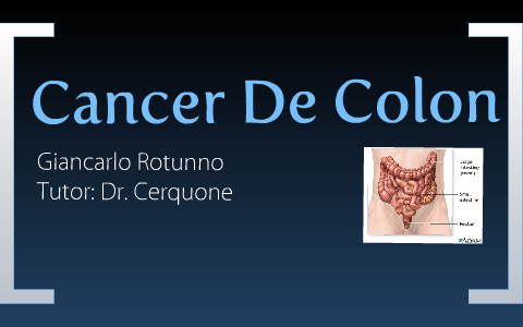 Cancer de Colon by Giancarlo Rotunno on Prezi