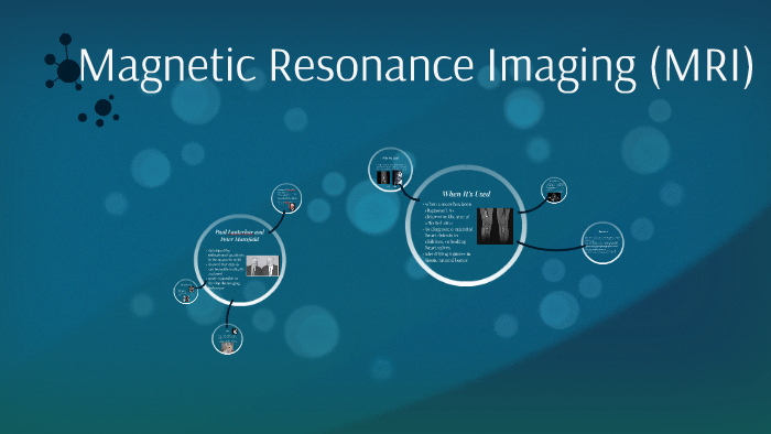 Magnetic Resonance Imaging (MRI) by Katryna Thibert on Prezi
