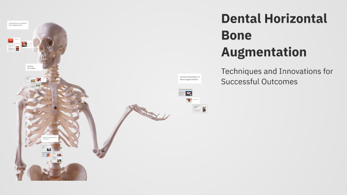 Dental Horizontal Bone Augmentation by Rena Mansour on Prezi