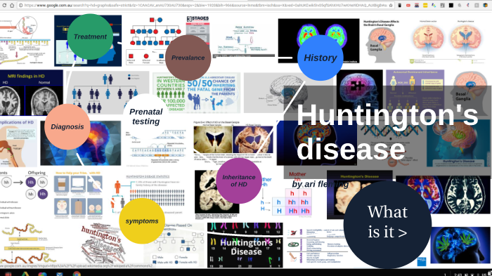 Huntingtons Disease By Ari Fleming On Prezi