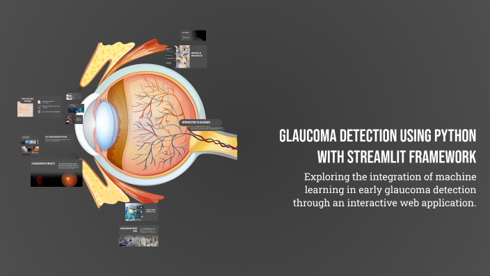 Glaucoma Detection Using Python with Streamlit Framework by ABDULLA D ...