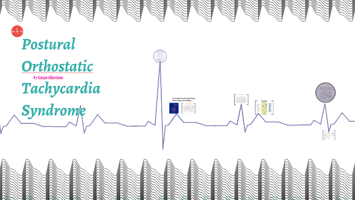 Postural Orthostatic Tachycardia Syndrome by Carys Obertone
