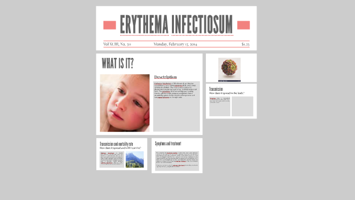 what-is-erythema-infectiosum-youtube