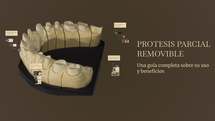PROTESIS PARCIAL REMOVIBLE by CLAUDIA MILENA SANCHEZ NIETO on Prezi