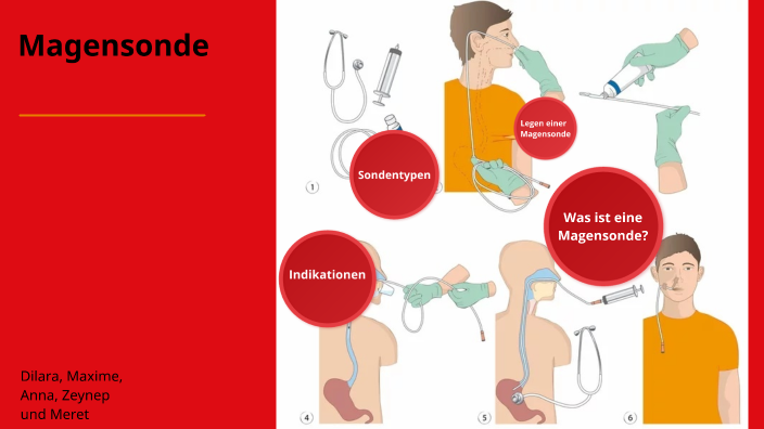 Wie Lange Kann Man Mit Einer Magensonde Leben prezi.com