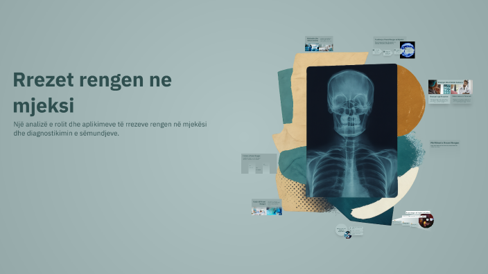 Medicina Rengen Rrezet rengen ne mjeksi by Olta Kolica on Prezi