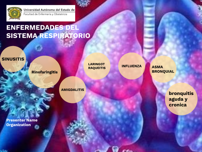 Enfermedades Respiratoria By Fernanda Elias On Prezi