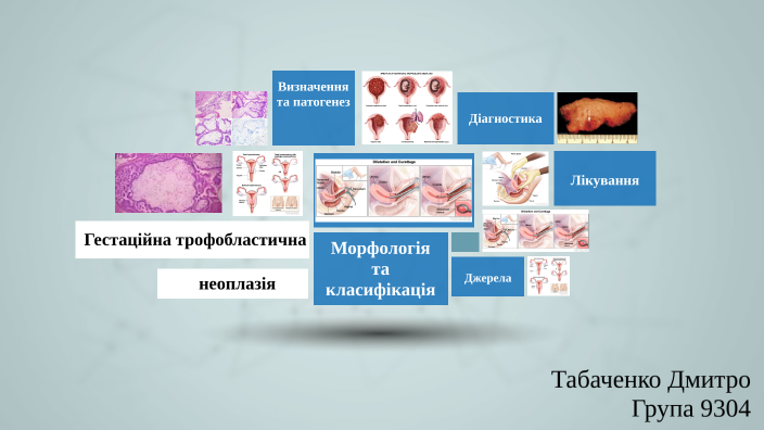 Tabachenko Gestational Trophoblastic Neoplasia by Dmytro Tabachenko on Prezi