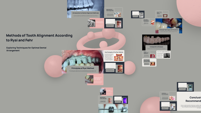 Methods of Tooth Alignment According to Rysi and Fehr by Anna P on Prezi