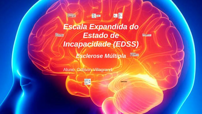 Escala Expandida do Estado de Incapacidade (EDSS) by Odilson Villagrand ...