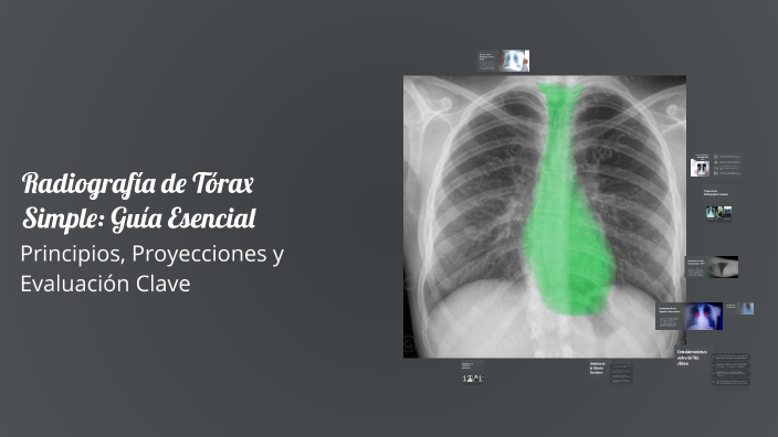 Torax Simple Radiografía de Tórax Simple: Guía Esencial by Ever Caballero on Prezi