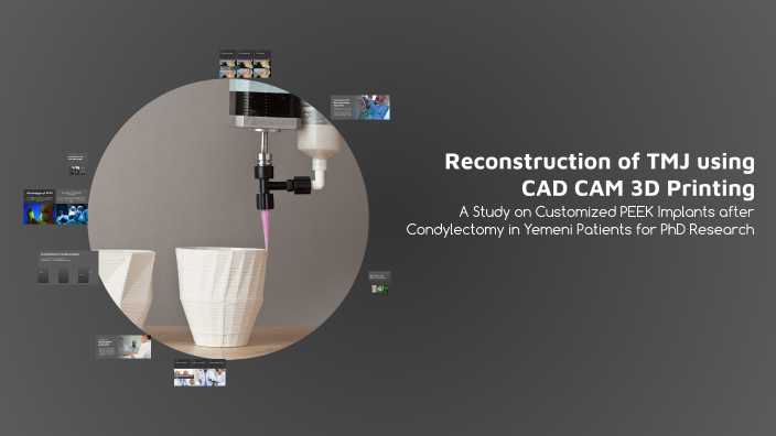 Reconstruction of TMJ using CAD CAM 3D Printing by د ماجد الجعفري on Prezi