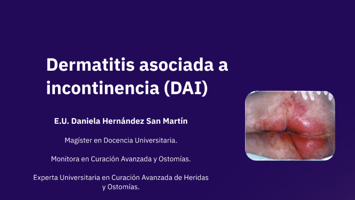 Dermatitis asociada a la incontinencia by Daniela Hernandez on Prezi