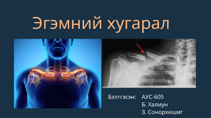 эгэм by Б. Халиун on Prezi