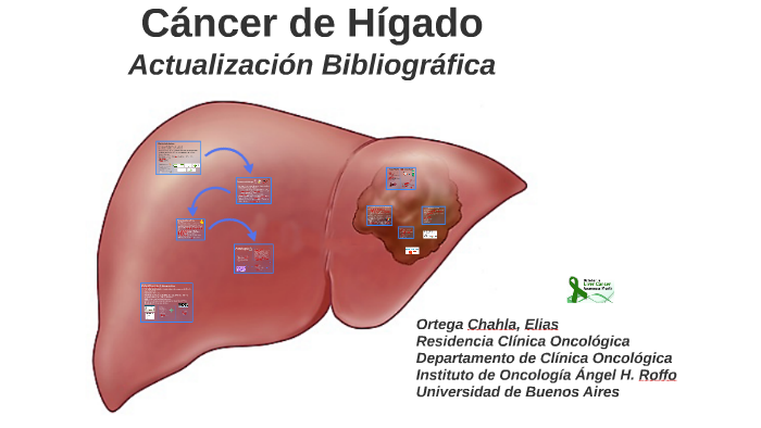 Lhi higado