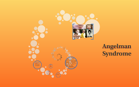 Angelman Syndrome by Hayley Lovell