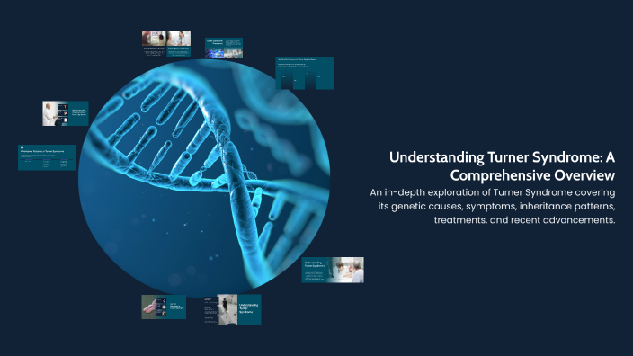 Understanding Turner Syndrome: A Comprehensive Overview by Tay Garcia ...