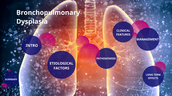 Bronchopulmonary Dysplasia by Kaila Feldmann on Prezi