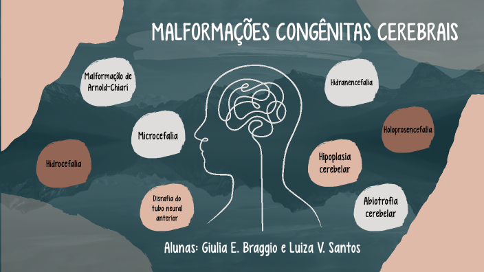 Malformações congênitas cerebrais by Giulia Braggio on Prezi