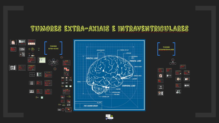 TUMORES EXTRA-AXIAIS E INTRAVENTRICULARES by Karla Oliveira on Prezi