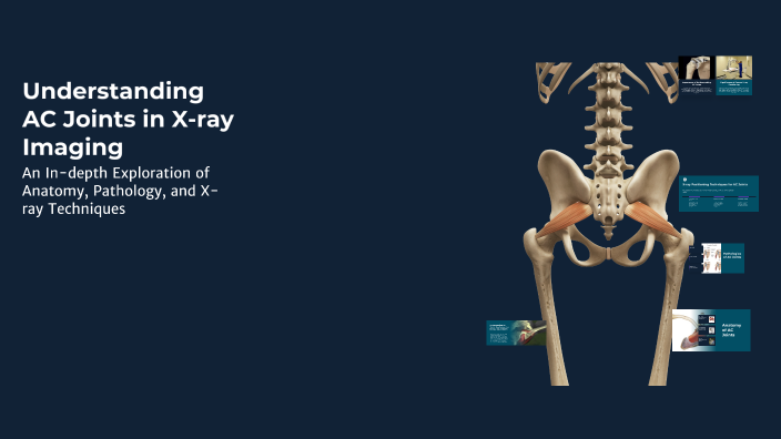 Understanding AC Joints in X-ray Imaging by sebastian garcia on Prezi