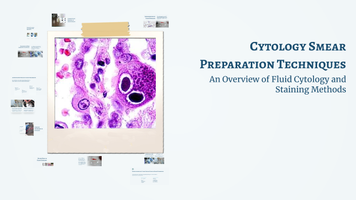 Cytology Smear Preparation Techniques by 102 Runishma Ks on Prezi