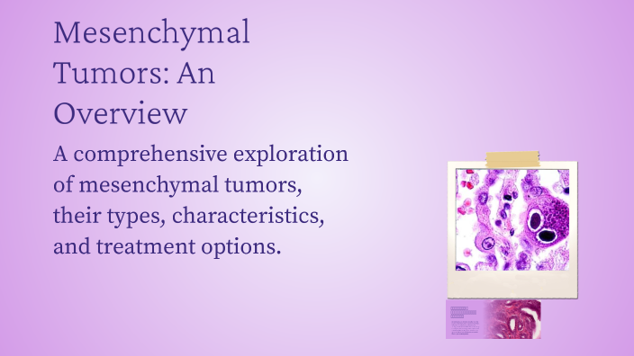 Mesenchymal Tumors: An Overview by Ziyoda Odilova on Prezi