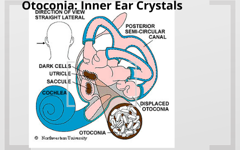 Otoconia: Inner Ear Crystals by Leigh Baney on Prezi