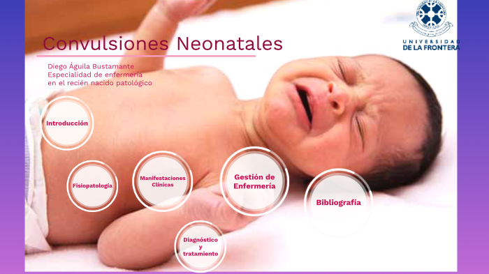 Convulsiones Neonatales By Diego Águila Bustamante On Prezi 5195