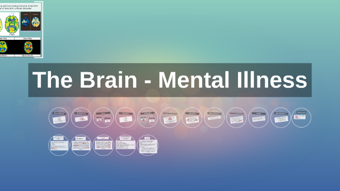 The Brain - Mental Illness by taylor corie on Prezi