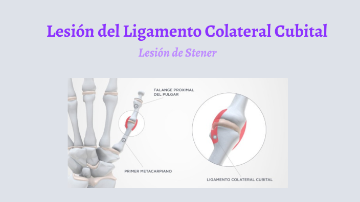 Lesi N Ligamento Colateral Cubital By Nerina Alessandri