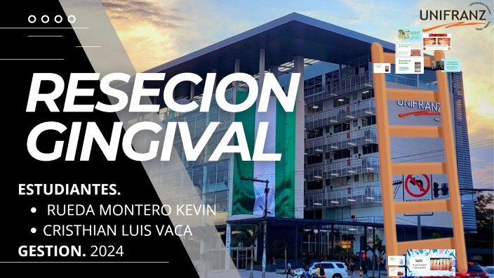 Recesiones Gingivales by Kevin Rueda Montero on Prezi