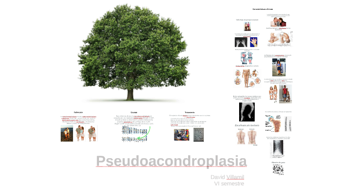 pseudoacondroplasia