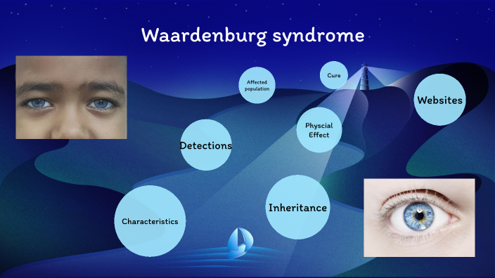 Waardenburg Syndrome By Ayden Daigle On Prezi