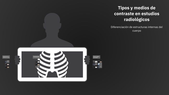 Tipos y medios de contraste en estudios radiológicos by Elmar Daniel ...