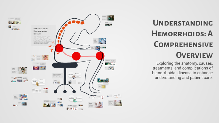 Understanding Hemorrhoids: A Comprehensive Overview by dr.pravin GUPTA ...