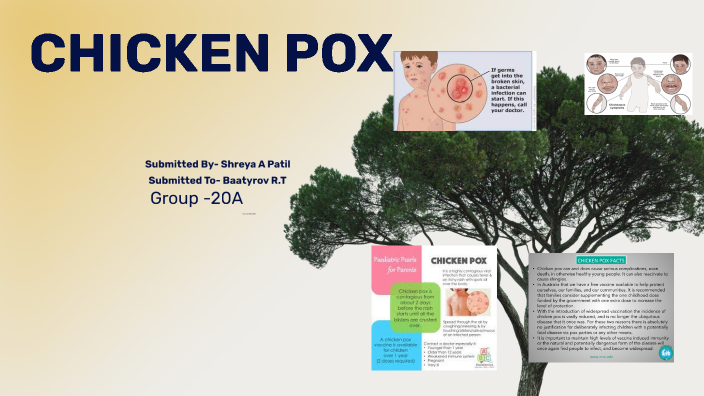 chicken pox by Shreya Patil on Prezi