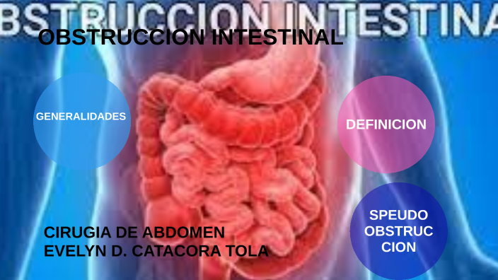 Obstruccion Intestinal By Evelyn Catacora On Prezi