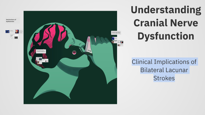 Understanding Cranial Nerve Dysfunction by Pamela Morgado on Prezi