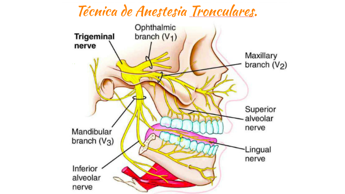 Tecnica de Anestesia Tronculares by Chena Molina on Prezi