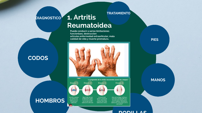 PATOLOGIAS REUMATICAS by ROXANA CASTILLA on Prezi