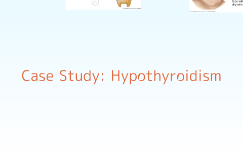 hypothyroidism case study