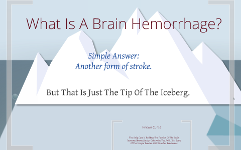 Brain Hemorrhages By Gunnar Andersson On Prezi Brain Hemorrhages By Gunnar Andersson On Prezi